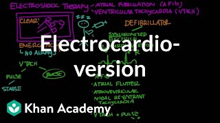 Electrocardioversion  Circulatory System and Disease  NCLEXRN  Khan Academy [upl. by Sila]