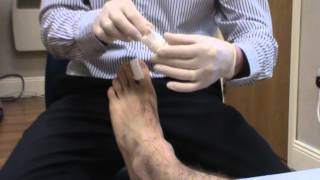 video 35 Toenail Dressing [upl. by Lukas]