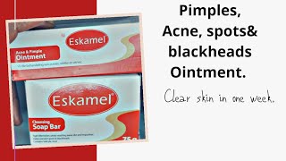 How to get rid of blackheads dark spots and Acne Eskamel ointment [upl. by Llenyl]