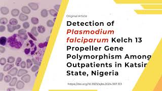 Detection of Plasmodium falciparum Kelch 13 Propeller Gene Polymorphism Among Outpatients [upl. by Lark]