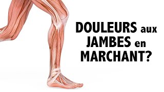 Douleurs aux jambes en marchant Le problème vient peutêtre des artères [upl. by Arikahs]