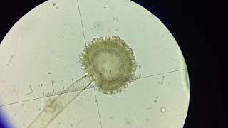 Aspergillus niger explained [upl. by Hepsibah422]