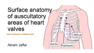 Surface anatomy of auscultatory areas of heart valves [upl. by Nonnel851]