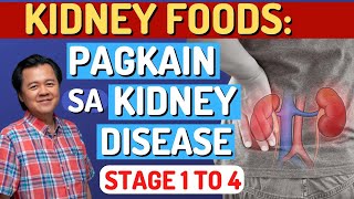 Kidney Foods Pagkain sa Kidney Disease Stage 1 to 4By Doc Willie Ong Internist and Cardiologist [upl. by Alael]