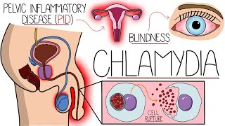 Understanding Chlamydia Chlamydia Trachomatis Explained Clearly [upl. by Adnuahs]