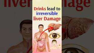 Drinks lead to irreversible liver damage [upl. by Darrej]