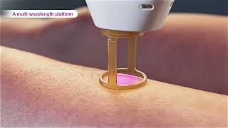 Laser hair removal  GentleMax Pro Plus 3D medical device animation [upl. by Anivram]