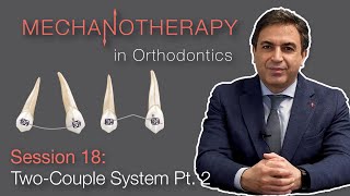 Mechanotherapy in Orthodontics TwoCouple System Pt 2 [upl. by Sulohcin]