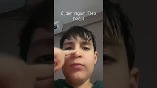 Cildim Yağlımı Testi Yağlı [upl. by Willms161]