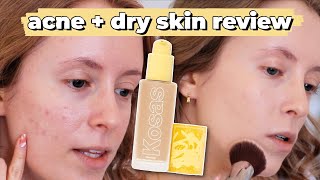 KOSAS Revealer Foundation FULLDAY WEAR TEST amp REVIEW for DryAcne Prone Skin [upl. by Aruol]