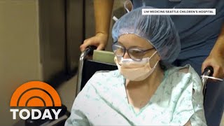 Survivor Of Conjoined Twin Surgery Gives Birth To Her Own Baby [upl. by Alegnatal39]