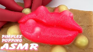 Unwind with a Pimple Popping Livestream on Realistic Silicone Models  Stress Relief Therapy [upl. by Adne]