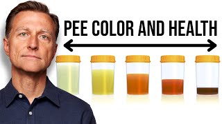 What Your URINE COLOR Says about Your Health [upl. by Eddi]