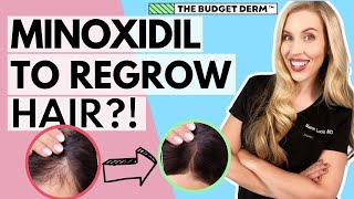 Minoxidil For Hair Loss  Everything you need to know [upl. by Rillings]