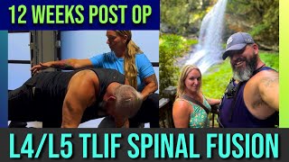 12 Weeks PostOP From My L4L5 TLIF Spinal Fusion SurgeryIs Life Almost Normal [upl. by Nylessej]