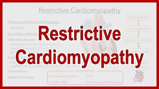 Restrictive Cardiomyopathy RCM [upl. by Pharaoh358]