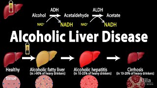 Alcoholic Liver Disease Animation [upl. by Dihsar]