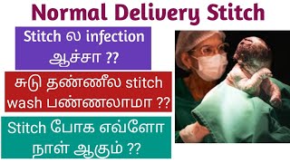 Episiotomy stitch cure tips tamil [upl. by Estella141]