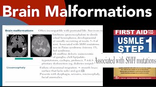 Brain malformations Holoprosencephaly amp Lissencephaly in HindiUrdu by first aid for USMLE step 1 [upl. by Yrad332]