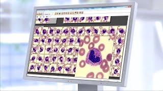 Introducing CellaVision® Peripheral Blood Application [upl. by Lust]