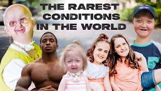 10 Of The Rarest Conditions In The World  BORN DIFFERENT [upl. by Islek911]