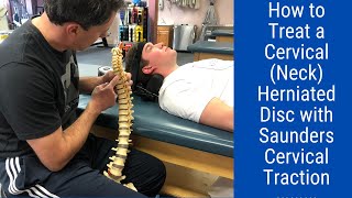 How to Treat a CervicalNeck Herniated DiscSaunders Cervical Traction [upl. by Isa]