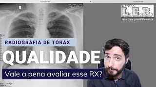 Como descobrir se a Radiografia de Tórax está bem feita  Galvani Filho [upl. by Gnemgnok]