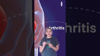 Part2 Rheumatoid arthritis Symptoms and Precautions  health healthylifestyle facts shorts [upl. by Latsirhc]