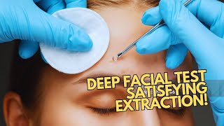 Satisfying Deep Facial Extraction Moments  Professional Review  Skin Extraction  Pores Cleaning [upl. by Damita]