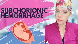 What is a subchorionic hemorrhage or hematoma [upl. by Wyly]