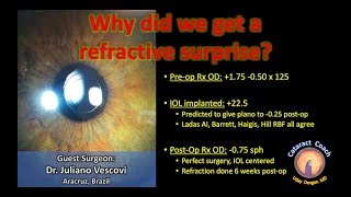 Why did we get a refractive surprise after Cataract Surgery [upl. by Nata]