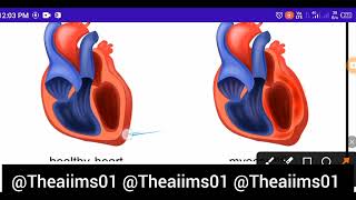 Myocarditis Heart diseases MNS topic for NORCET preparation Bsc nursing Gnm ANM competitive exams [upl. by Meng]