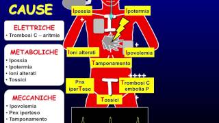 Le 3E dellarresto cardiorespiratorio ECG EGA ECO [upl. by Relyat970]