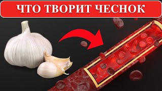 🧄 Ешьте ЧЕСНОК но НИКОГДА НЕ ДОПУСКАЙТЕ ЭТИ 7 ОШИБОК [upl. by Ilyah706]