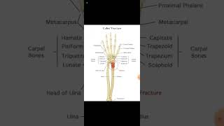 colles fracture is a broken wrist fracturesistersudipta1737 [upl. by Nell]