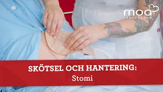 Skötsel och hantering  Stomi [upl. by Larrabee868]