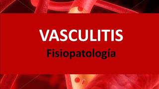 Vasculitis  Fisiopatología [upl. by Evelinn]