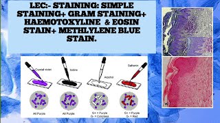 Simple stainingGram StainingHampE staining [upl. by Suertemed]