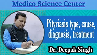 Pityriasis type cause diagnosis treatment  सिहुली DrDeepak Singh [upl. by Brunk]