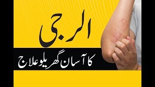 Natural Home Remedies For Skin Allergy in UrduAllergy Ka Asan ilaj [upl. by Haleemak225]