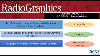 vertebral artery dissection dr Iman eltantawy [upl. by Dorran620]