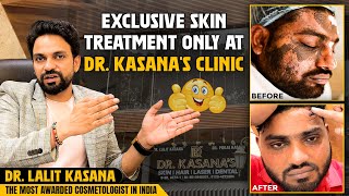 Exclusive Skin Treatment Only At DrKasanas Clinic [upl. by Best]