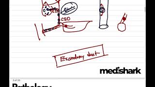 General Pathology Class 6 Metaplasia Dr Murtoza Shahriar [upl. by Tullus]