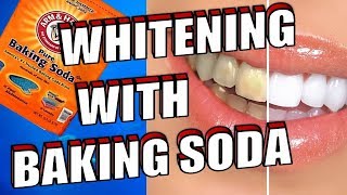 How To Easily WHITEN Your TEETH With BAKING SODA [upl. by Eelatan736]