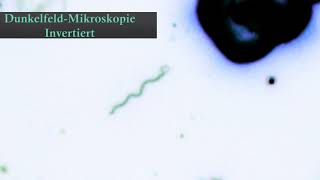 Polymorphismus unter dem Mikroskop🔬Die Transformation der Bakterienzelle🔬Filamentouslikestructure🦠 [upl. by Herzel29]