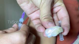 What is Tetanus Vaccine and how it is given intramuscularly  intramuscularinjection tetanus [upl. by Oznofla530]