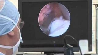 Equine Arthroscopic Surgery [upl. by Cyrilla855]