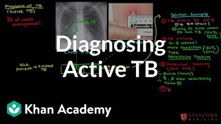 Diagnosing active TB  Infectious diseases  NCLEXRN  Khan Academy [upl. by Ananna]