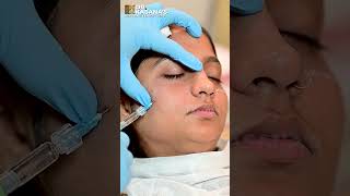 Under Eye Filler Treatment with DrPooja Kasanas [upl. by Rickart]