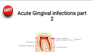 primary herpetic gingivostomatitis [upl. by Ellerehs]